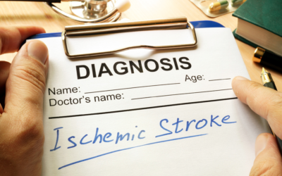 Understanding Ischemic Stroke